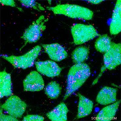 Targeted Cancer Therapy: Harnessing Sticky Nanoparticles for Precision Drug Delivery