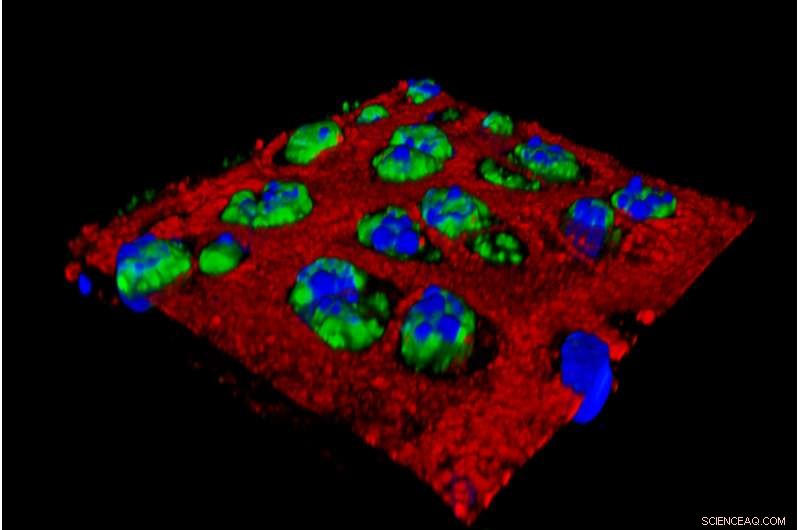 Nanoparticles: The Next Frontier in Osteoarthritis Treatment