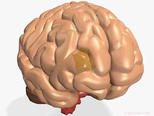 Non-Invasive Gentle Sensors for Precise Brain Disorder Diagnosis