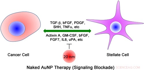 Gold Nanoparticles Show Promise as a New Pancreatic Cancer Therapy
