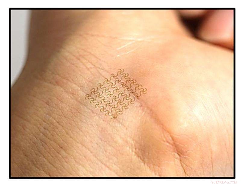 Long‑Lasting, Stretchy Biomedical Skin‑Like Bandage Offers Durable Protection