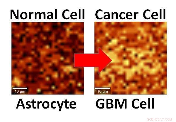 Graphene Breakthrough: First Successful Detection of Cancer Cells