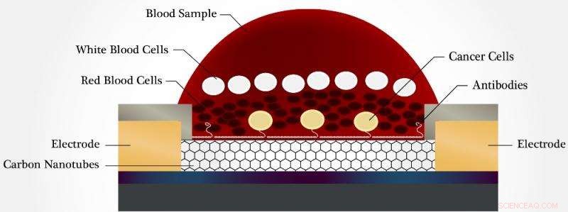 WPI Engineers Create Liquid Biopsy Chip for Early Detection of Metastatic Cancer Cells
