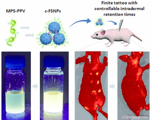 Smart Tattoos Help Surgeons Locate Precise Surgical Sites—Then Disappear