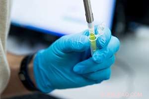 Revolutionary Nanoparticle Test Offers Faster Breast Cancer Diagnosis