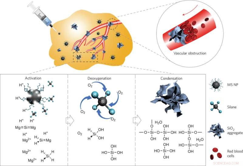 Nanoparticles Proven Effective as Tumor Deoxygenation Agents in Cancer Therapy