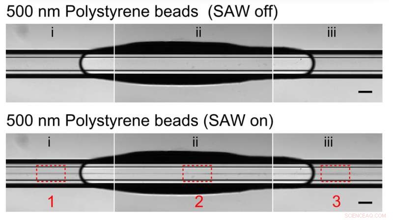 Duke University Engineers Use Acoustic Whirlpools to Detect Tiny Disease Markers