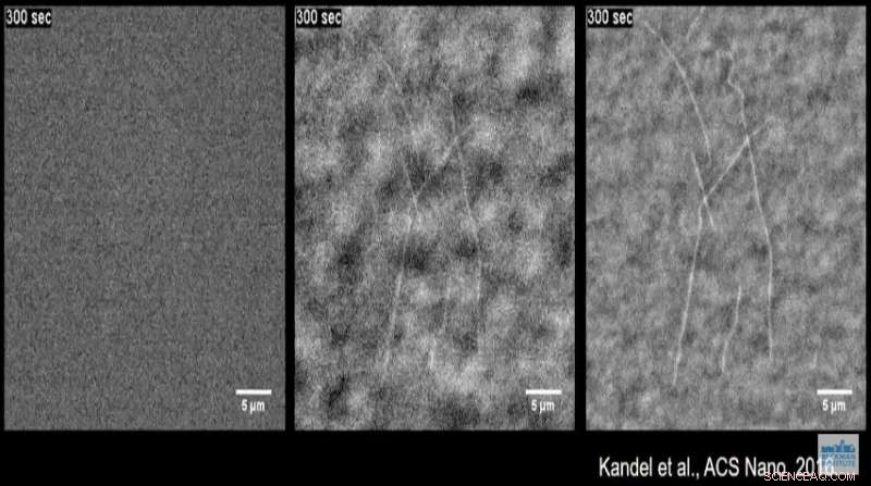 New Label‑Free Imaging Method Reveals Microtubules with Unprecedented Clarity