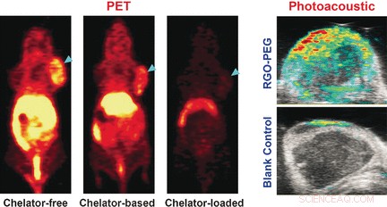 Radiolabeled Nanographene Without Chelators: A Reliable Tool for Bioimaging