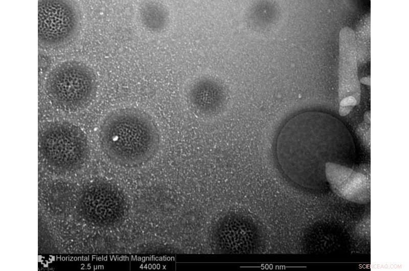 Advanced Lipid Nanoparticles: Revolutionizing Gene Therapy Delivery