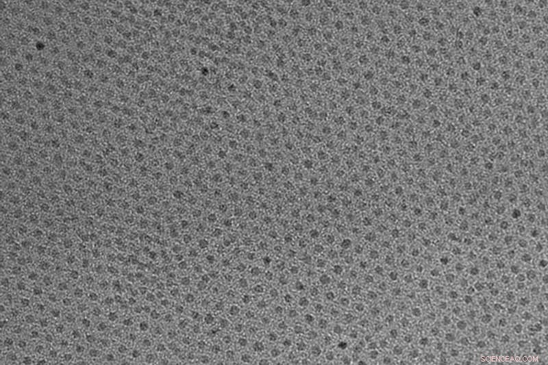 New Iron Oxide Nanoparticles May Eliminate Rare MRI Contrast Agent Side Effects