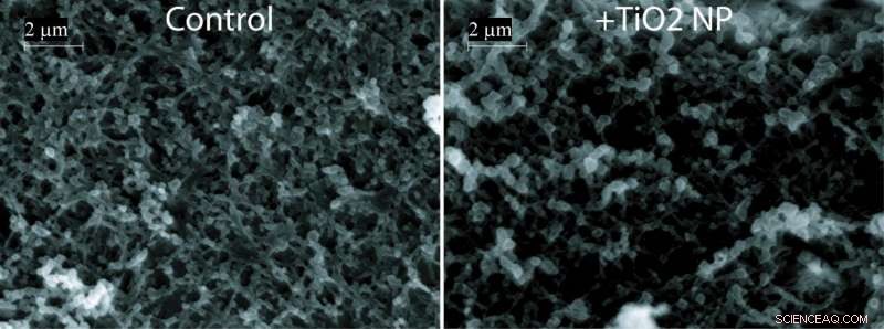 Titanium Dioxide in Candy and Gum May Disrupt Intestinal Cells, Study Finds