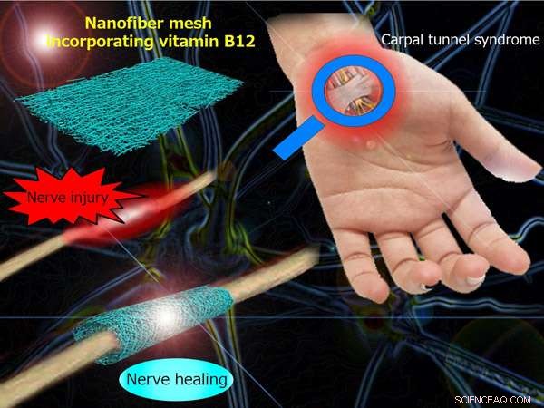 Advanced Nanofiber Mesh Enhances Peripheral Nerve Regeneration