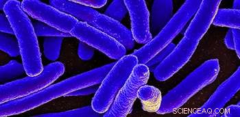 Widespread Nanosilver Use Threatens Antimicrobial Effectiveness, Researchers Warn