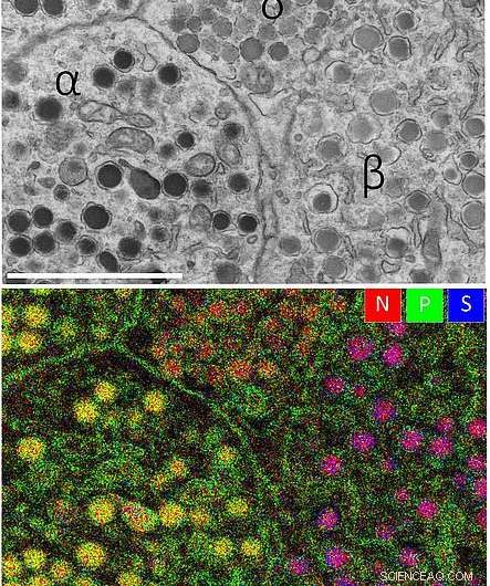Advanced Detector Technique Illuminates Biomolecules in Tissue