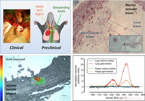 Nanoparticles Traverse the Lung Barrier to Blood: Unveiling Heart Disease Risks