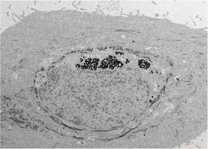 UC San Diego Scientists Develop Advanced Natural Sunscreen Using Melanin-like Nanoparticles