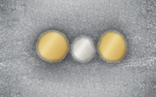 Gold Nanoparticle Chains Pave the Way for Efficient Light Conduction
