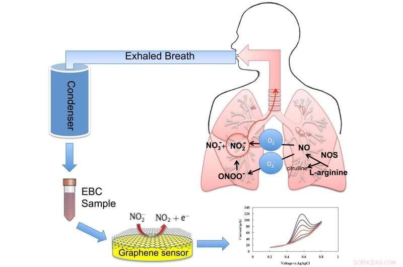 Graphene Sensor Enhances Asthma Diagnosis and Treatment