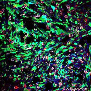 Enhanced Drug Delivery to Brain Tumors Using Surface-Modified Nanoparticles