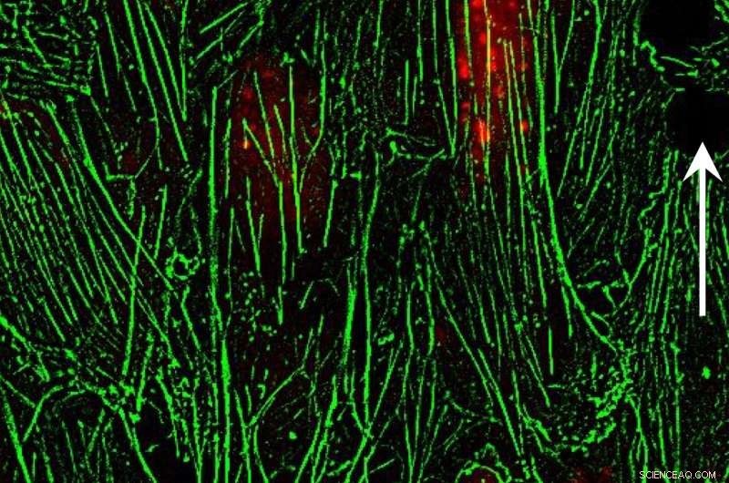 On-Demand Vascular Permeability Boosts Targeted Drug Delivery