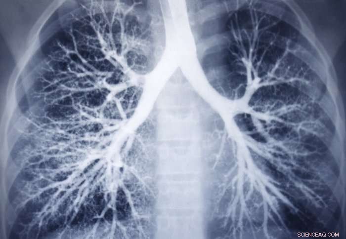 Revolutionary Nano-Drug Carriers: A Promising Future for Lung Disease Patients