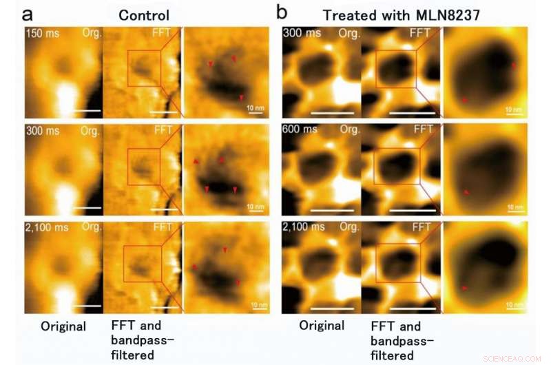 High-Speed AFM Reveals Nuclear Pore Dynamics in Colon Cancer Cells