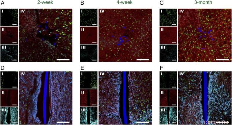 Injectable Flexible Neural Probe Integrates Seamlessly with Neurons, Minimizing Chronic Immune Response