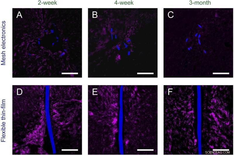 Injectable Flexible Neural Probe Integrates Seamlessly with Neurons, Minimizing Chronic Immune Response