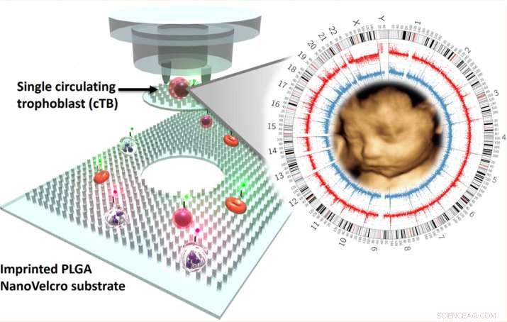 NanoVelcro Microchips: The Future of Noninvasive Prenatal Diagnosis