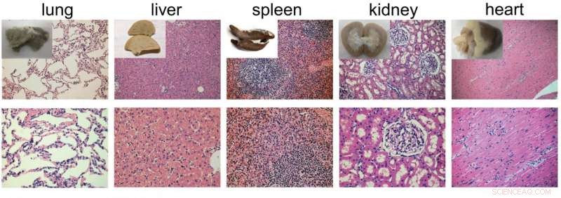 New MRI Contrast Agent Successfully Tested in Large Animal Models