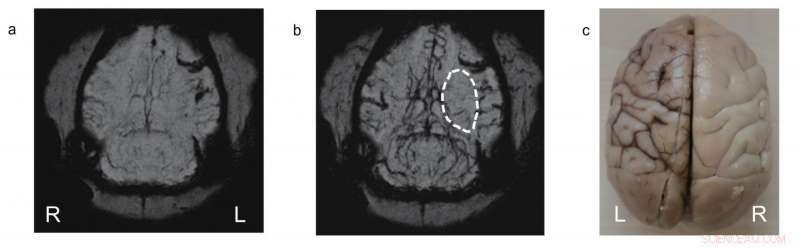 New MRI Contrast Agent Successfully Tested in Large Animal Models