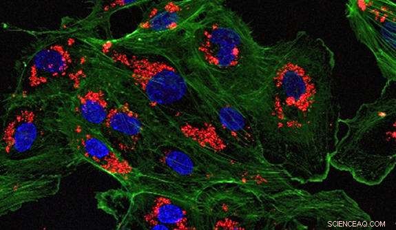 Nanoparticle-Delivered Drugs Reduce Transplant Rejection, Yale Study Shows