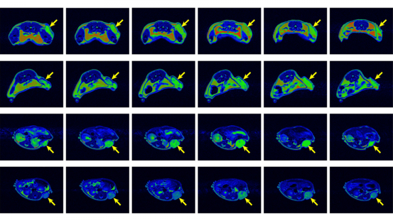 Metal-Free Nanoparticle Enhances MRI Precision for Tumor Detection