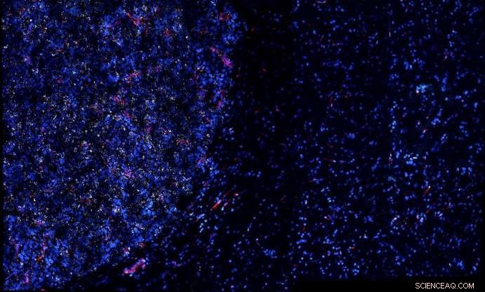 Gold Nanostars Boost Immunotherapy, Vaccinating Mice Against Cancer