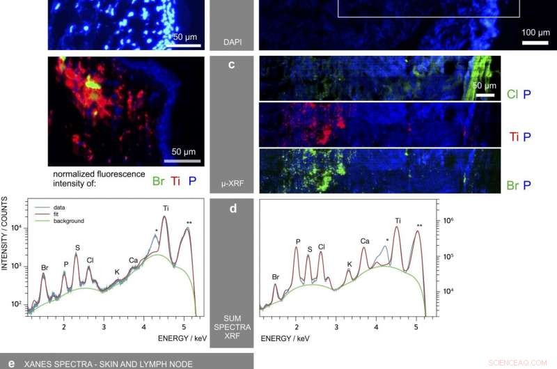 Study Reveals Tattoo Nanoparticles Circulate Through the Body