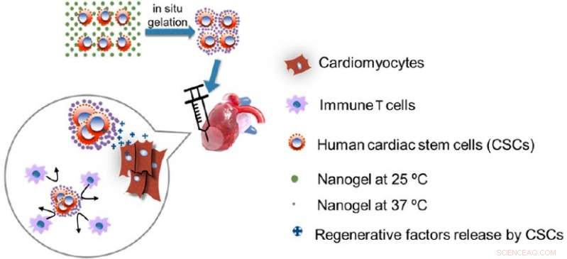 Nanogel-Encapsulated Stem Cells Offer Hope for Heart Attack Recovery