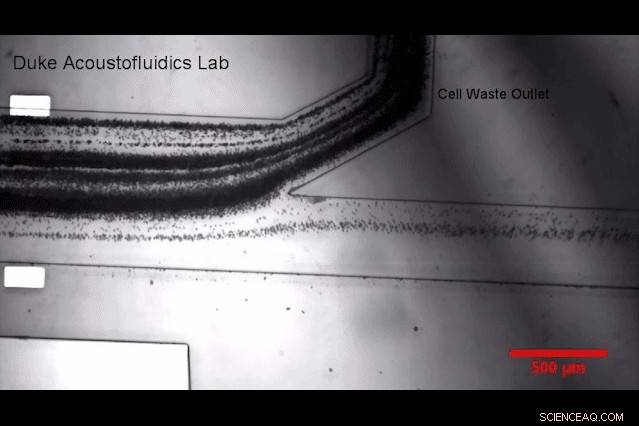 Sound‑Wave Blood Test Could Replace Certain Tissue Biopsies