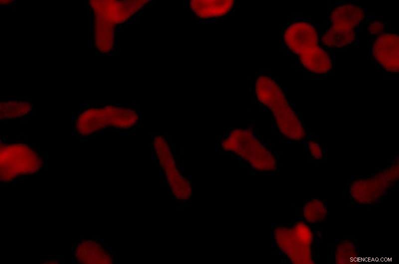 Nature‑Inspired Plastic Nanoparticles Offer a Breakthrough in Cancer Drug Delivery