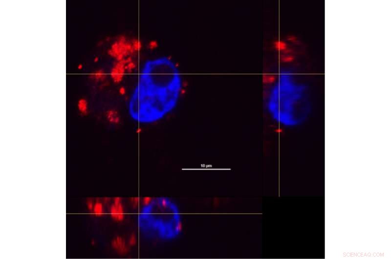 Nanoshells Enable Higher Chemotherapy Doses with Reduced Side Effects