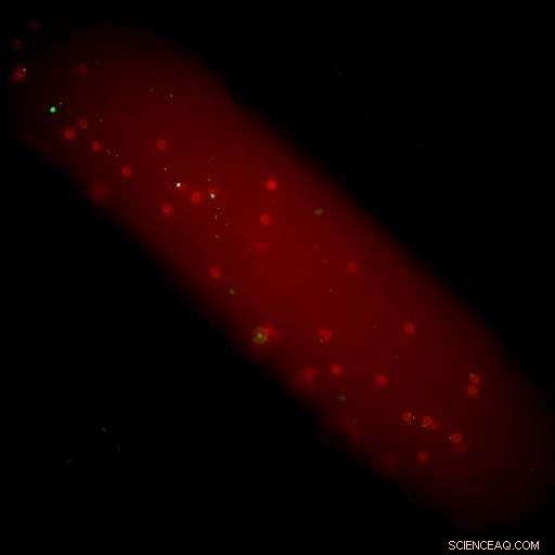 How Nanoparticles Reduce Inflammation by Modulating the Immune Response