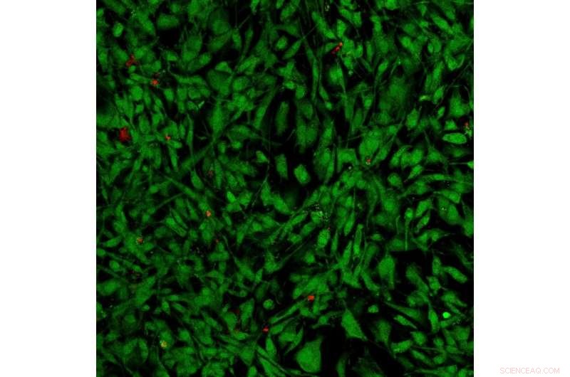 Kevlar-Based Artificial Cartilage Replicates the Superior Strength of Natural Tissue