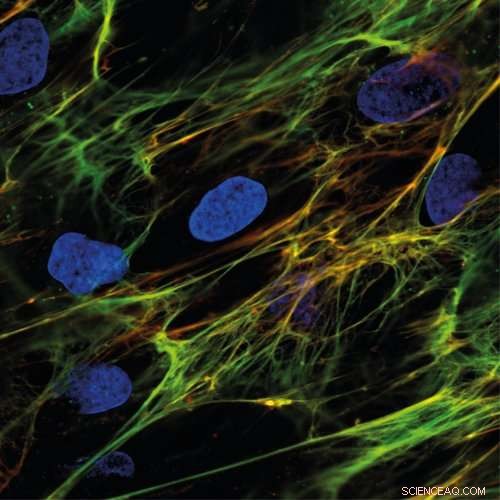 Precision Nano-Sensor Quantifies Tissue Fiber Tension