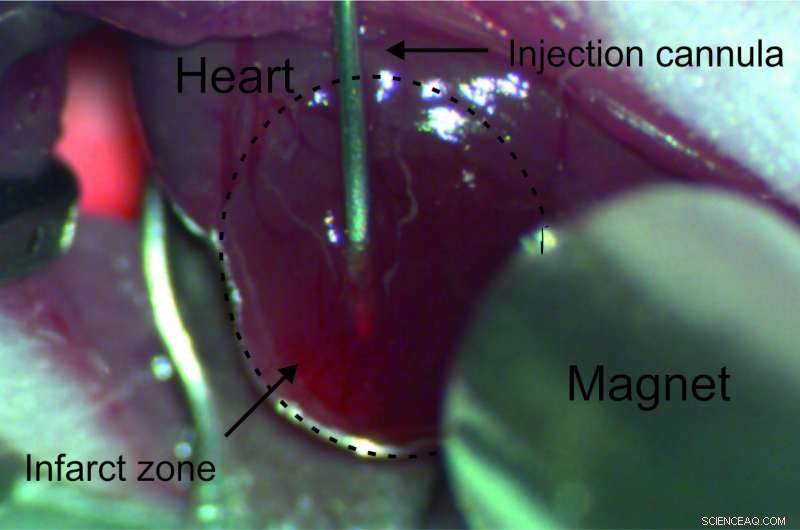 Nanoparticle Tandems: A Novel Strategy to Combat Myocardial Infarction