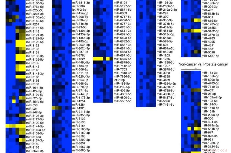 Nanowire Urine Test Enables Rapid, Non‑Invasive Cancer Detection