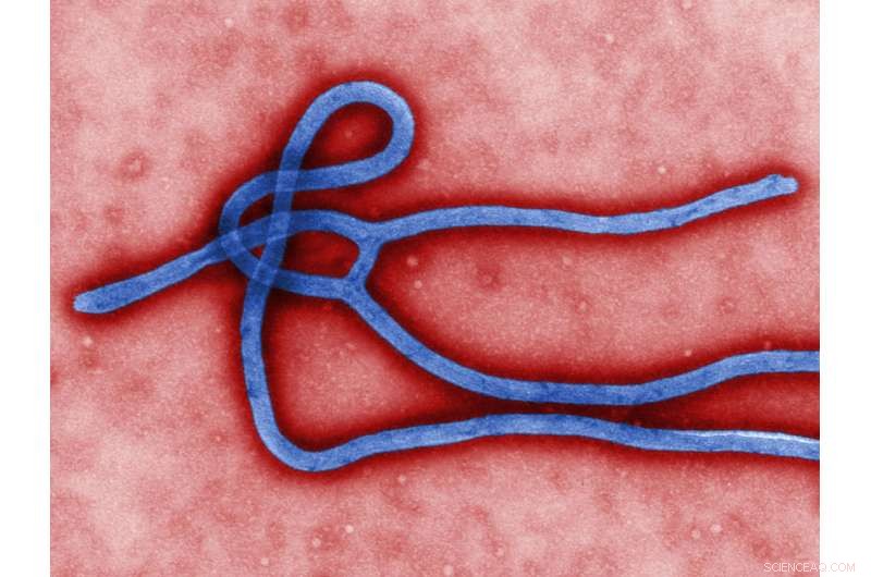 Revolutionary Ebola Immunity Test Offers Faster, Reliable Diagnosis
