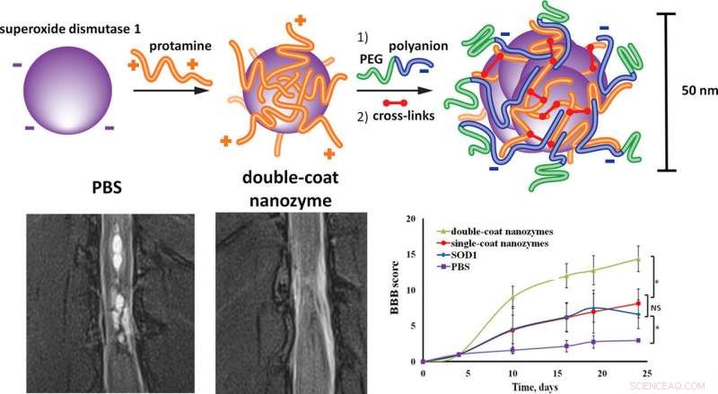 Scientists Develop Nanoparticle Antioxidants to Treat Strokes, Spinal Cord Injuries