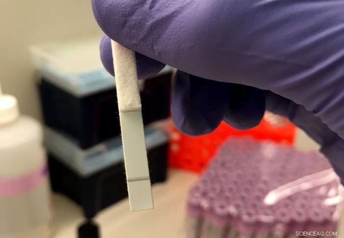 Imperial College Develops Rapid HIV Test for Early Detection