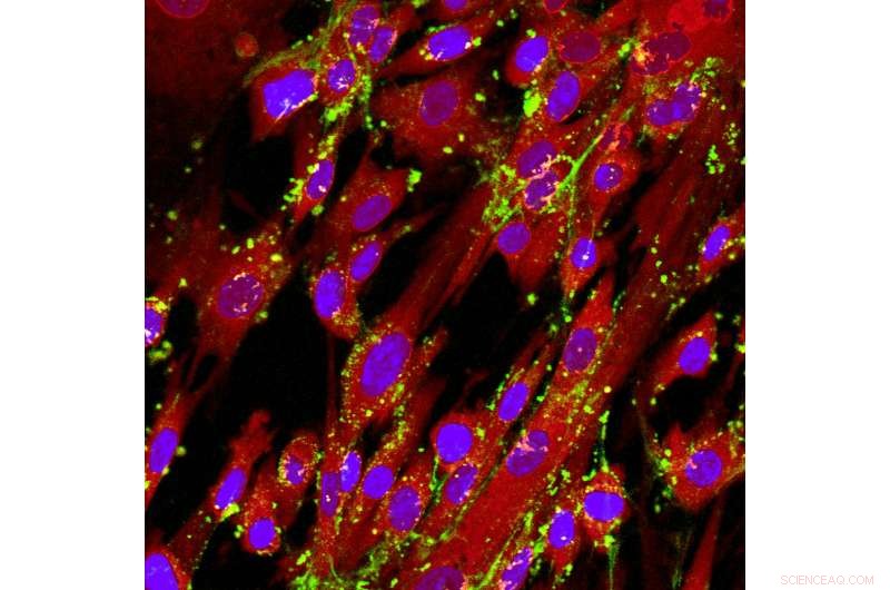 Cell Sex Significantly Influences Nanomedicine Outcomes