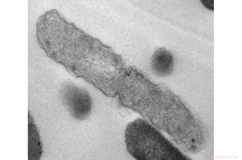 RMIT Scientists Develop Light-Driven Nanozyme to Eliminate Bacteria
